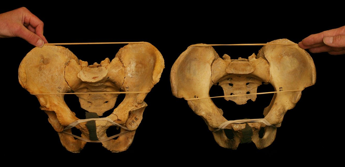 Hip_Socket_1-e1506903601368