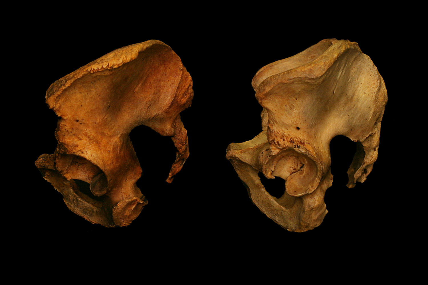 Hip_Socket_3-e1506903558221