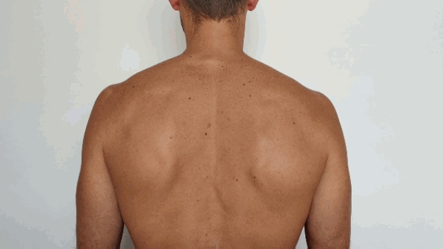 Retracción escapular